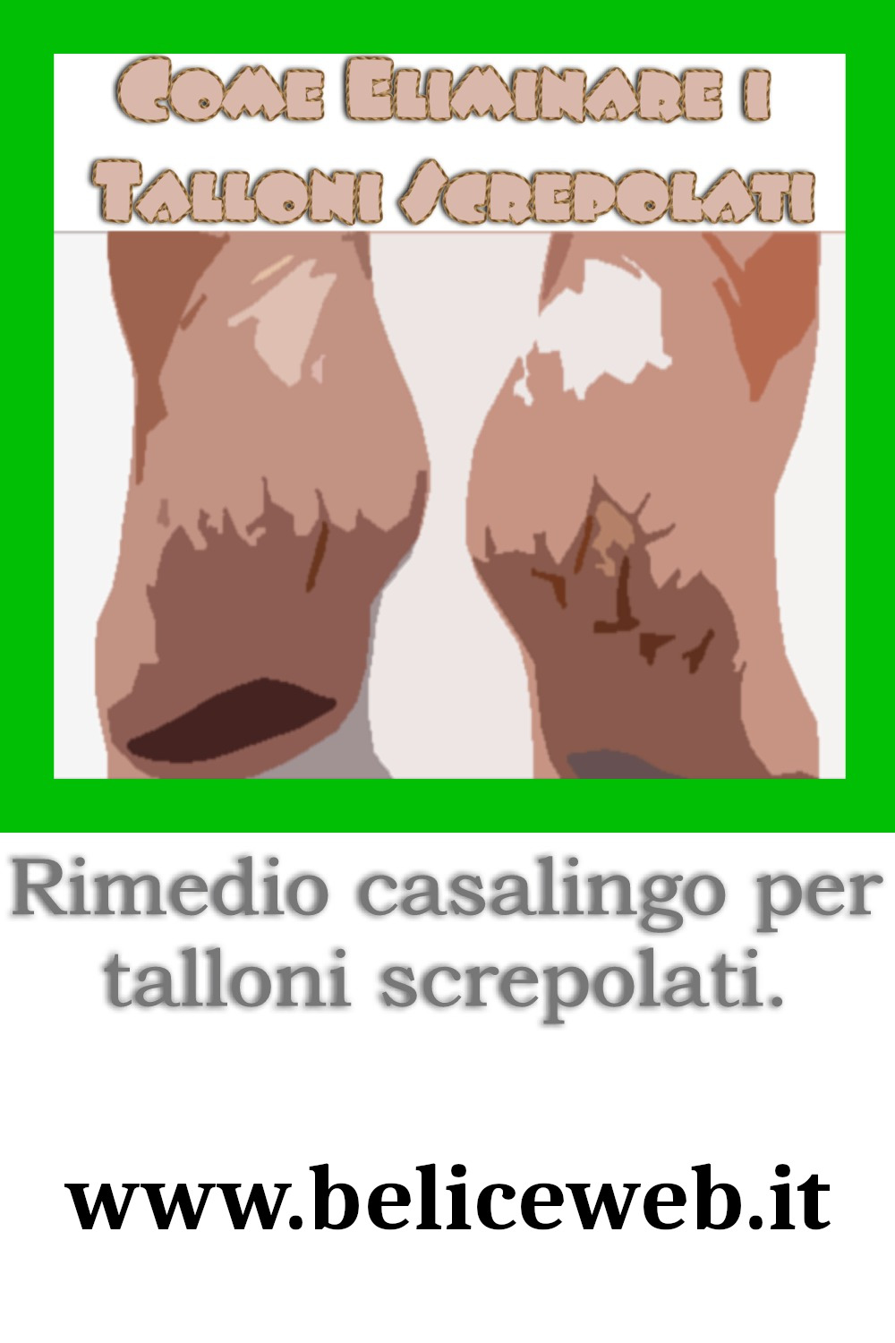 Come Eliminare i Talloni Screpolati - Rimedio casalingo semplice e funzionante.